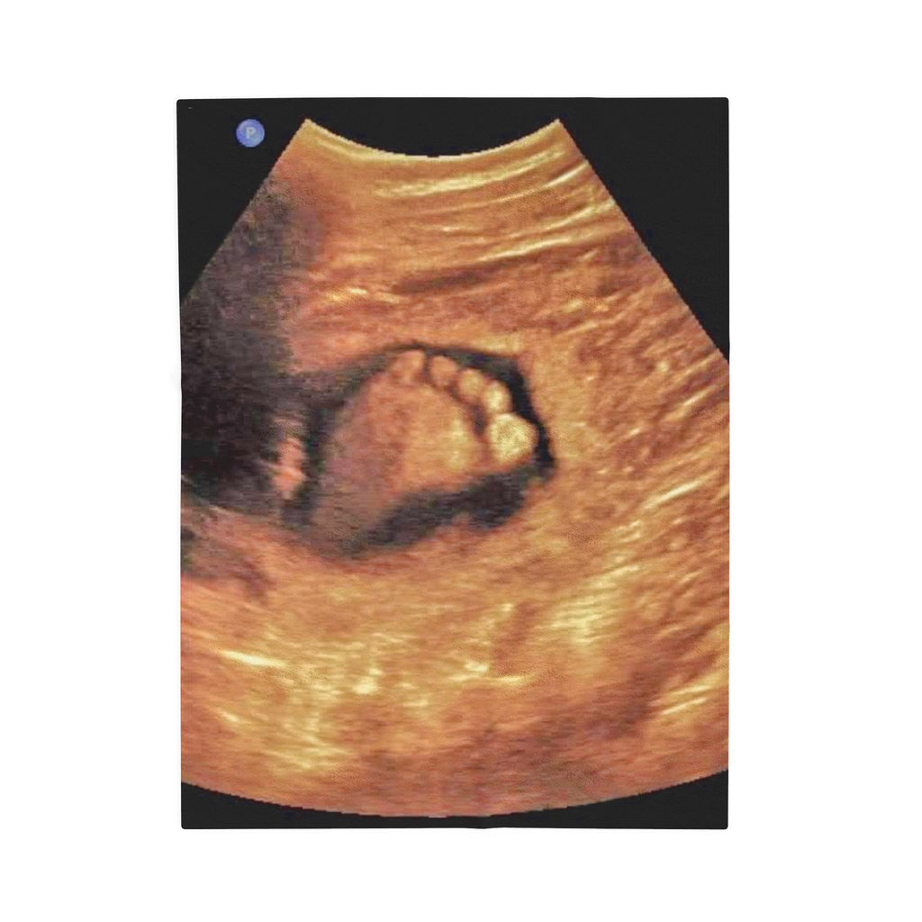 Velveteen Plush Blanket - Ultrasound Baby